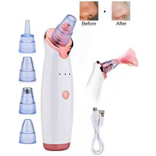Portable Blackhead Remover – Home Use Suction Tool