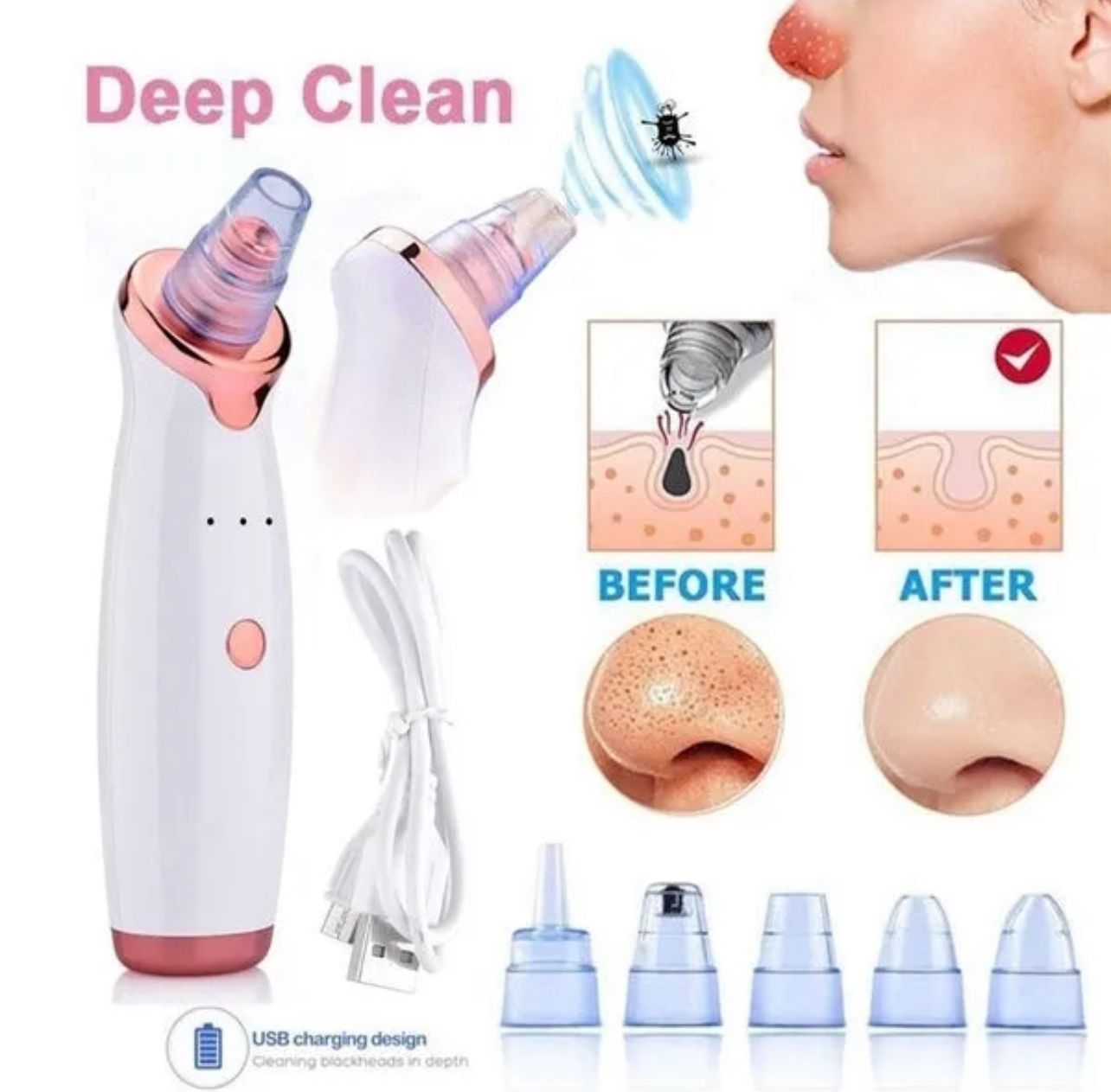 Portable Blackhead Remover – Home Use Suction Tool